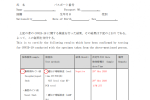 2020年如何入境日本，日本入境流程及准备材料汇总